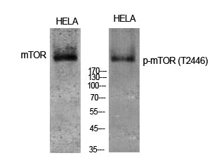 Western Blot analysis of HELA cells using Phospho-mTOR (T2446) Polyclonal Antibody