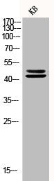 Western Blot analysis of KB cells using Phospho-ERK 1/2 (Y222/205) Polyclonal Antibody