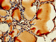 IHC image of CSB-PA00065A0Rb diluted at 1:250 and staining in paraffin-embedded human thyroid tissue performed on a Leica BondTM system. After dewaxing and hydration, antigen retrieval was mediated by high pressure in a citrate buffer (pH 6.0). Se...