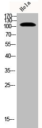 Western Blot analysis of Hela cells using Phospho-EphB1/2 (Y594/604) Polyclonal Antibody