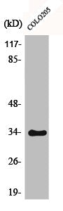 Western Blot analysis of COLO205 cells using Phospho-Cdk2/Cdc2 (T160) Polyclonal Antibody