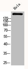 Western Blot analysis of HELA cells using Phospho-ACCα (S80) Polyclonal Antibody