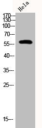 Western Blot analysis of Hela cells using Phospho-PFK-2 car (S483) Polyclonal Antibody