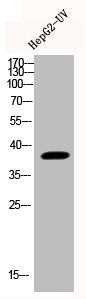 Western Blot analysis of HEPG2-UV cells using Phospho-p38 (Y323) Polyclonal Antibody