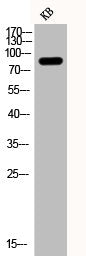 Western Blot analysis of KB cells using Phospho-PI 3-kinase p85α (Y607) Polyclonal Antibody