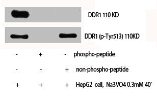 Western Blot analysis of HepG2 cells using Phospho-DDR1 (Y513) Polyclonal Antibody