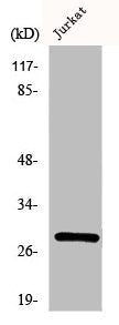 Western Blot analysis of Jurkat cells using Phospho-14-3-3 ζ (S58) Polyclonal Antibody