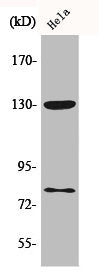 Western Blot analysis of HeLa cells using Phospho-Adducin α/β (S726/713) Polyclonal Antibody
