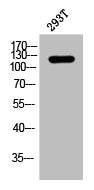 Western Blot analysis of 293T cells using Phospho-p120 (Y228) Polyclonal Antibody