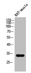 Western Blot analysis of RAT-musle cells using Phospho-DARPP-32 (T34) Polyclonal Antibody