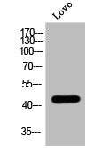 Western Blot analysis of Lovo cells using Phospho-MOR-1 (S375) Polyclonal Antibody