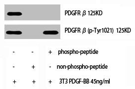 Western Blot analysis of NIH-3T3+PDGF cells using Phospho-PDGFR-β (Y1021) Polyclonal Antibody
