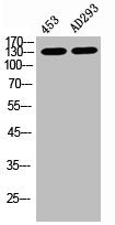 Western Blot analysis of 453 AD293 cells using Phospho-PERK (T981) Polyclonal Antibody