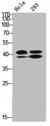 Western Blot analysis of HELA 293 cells using Phospho-ERK 1/2 (T202/Y204) Polyclonal Antibody