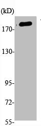 Western Blot analysis of K562, cells using Phospho-Tensin-1 (Y1326) Polyclonal Antibody