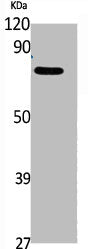 Western Blot analysis of K562, cells using Phospho-Rad17 (S646) Polyclonal Antibody