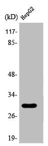 Western Blot analysis of Jurkat cells using 14-3-3 β Polyclonal Antibody