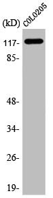 Western Blot analysis of COLO205 cells using A Cyclase I Polyclonal Antibody