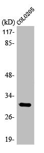 Western Blot analysis of HuvEc cells using ABHD11 Polyclonal Antibody