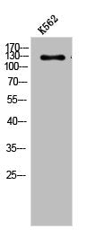 Western Blot analysis of K562 cells using Abl1/2 Polyclonal Antibody