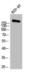 Western Blot analysis of 823-AV cells using ACCα Polyclonal Antibody