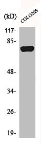 Western Blot analysis of Jurkat cells using ACSL6 Polyclonal Antibody