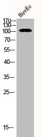 Western Blot analysis of HUVEC cells using ADAMTS-1 Polyclonal Antibody