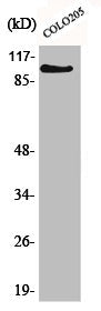 Western Blot analysis of Jurkat cells using AF-10 Polyclonal Antibody
