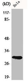 Western Blot analysis of HeLa cells using AI-BP Polyclonal Antibody