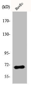 Western Blot analysis of Jurkat cells using AIF-M1 Polyclonal Antibody