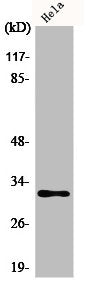 Western Blot analysis of Jurkat cells using AIG-1 Polyclonal Antibody