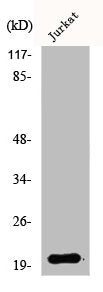 Western Blot analysis of Jurkat cells using AK6 Polyclonal Antibody