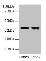 Western blot All lanes: ARHGDIA antibody at 1:500 Lane 1: EC109 whole cell lysate Lane 2: 293T whole cell lysate Secondary Goat polyclonal to rabbit IgG at 1/15000 dilution Predicted band size: 24, 19 kDa Observed band size: 40 kDa