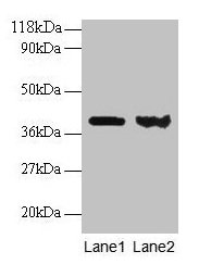 Western blot All lanes: ARHGDIA antibody at 1:500 Lane 1: EC109 whole cell lysate Lane 2: 293T whole cell lysate Secondary Goat polyclonal to rabbit IgG at 1/15000 dilution Predicted band size: 24, 19 kDa Observed band size: 40 kDa