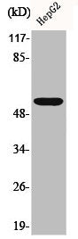 Western Blot analysis of COS7 cells using ALDH1B1 Polyclonal Antibody