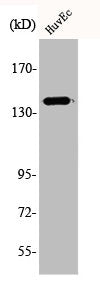 Western Blot analysis of HuvEc cells using Amyloid-β Polyclonal Antibody
