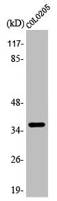 Western Blot analysis of COLO205 cells using Apaf-1-ALT Polyclonal Antibody