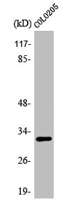 Western Blot analysis of COLO205 cells using APHC Polyclonal Antibody