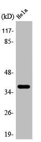 Western Blot analysis of K562 cells using Arginase II Polyclonal Antibody