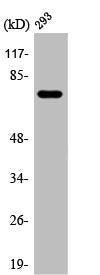 Western Blot analysis of Jurkat cells using ARHGAP18 Polyclonal Antibody