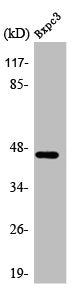 Western Blot analysis of BxPc3 cells using AR-β2 Polyclonal Antibody