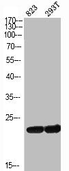 Western Blot analysis of 823 293T cells using ASC Polyclonal Antibody