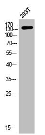 Western Blot analysis of 293T cells using ASK 1 Polyclonal Antibody