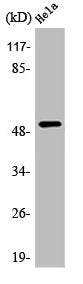 Western Blot analysis of HeLa cells using ATF-2 Polyclonal Antibody