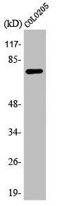 Western Blot analysis of COLO205 cells using ATF-6β Polyclonal Antibody