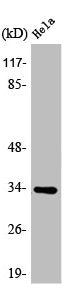 Western Blot analysis of Jurkat cells using ATP5C1 Polyclonal Antibody