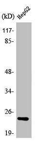 Western Blot analysis of Jurkat cells using ATP5H Polyclonal Antibody
