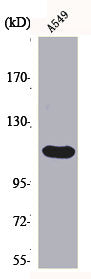 Western Blot analysis of A549 cells using Bek Polyclonal Antibody