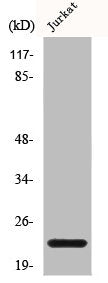 Western Blot analysis of Jurkat cells using BID Polyclonal Antibody