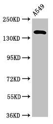 Western Blot Positive WB detected in: A549 whole cell lysate All lanes: A2ML1 antibody at 3.2µg/ml Secondary Goat polyclonal to rabbit IgG at 1/50000 dilution Predicted band size: 162, 106 kDa Observed band size: 162 kDa